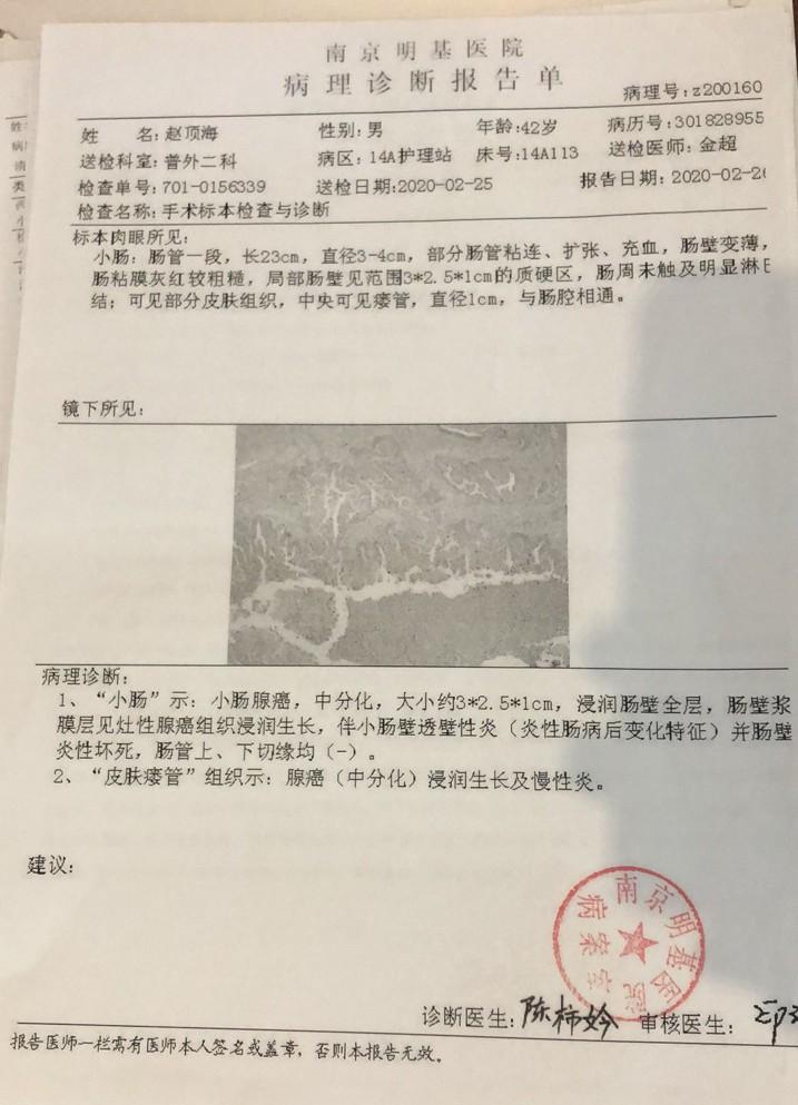 16岁哥哥与弟弟的抗癌之旅，逆境中的坚守与希望