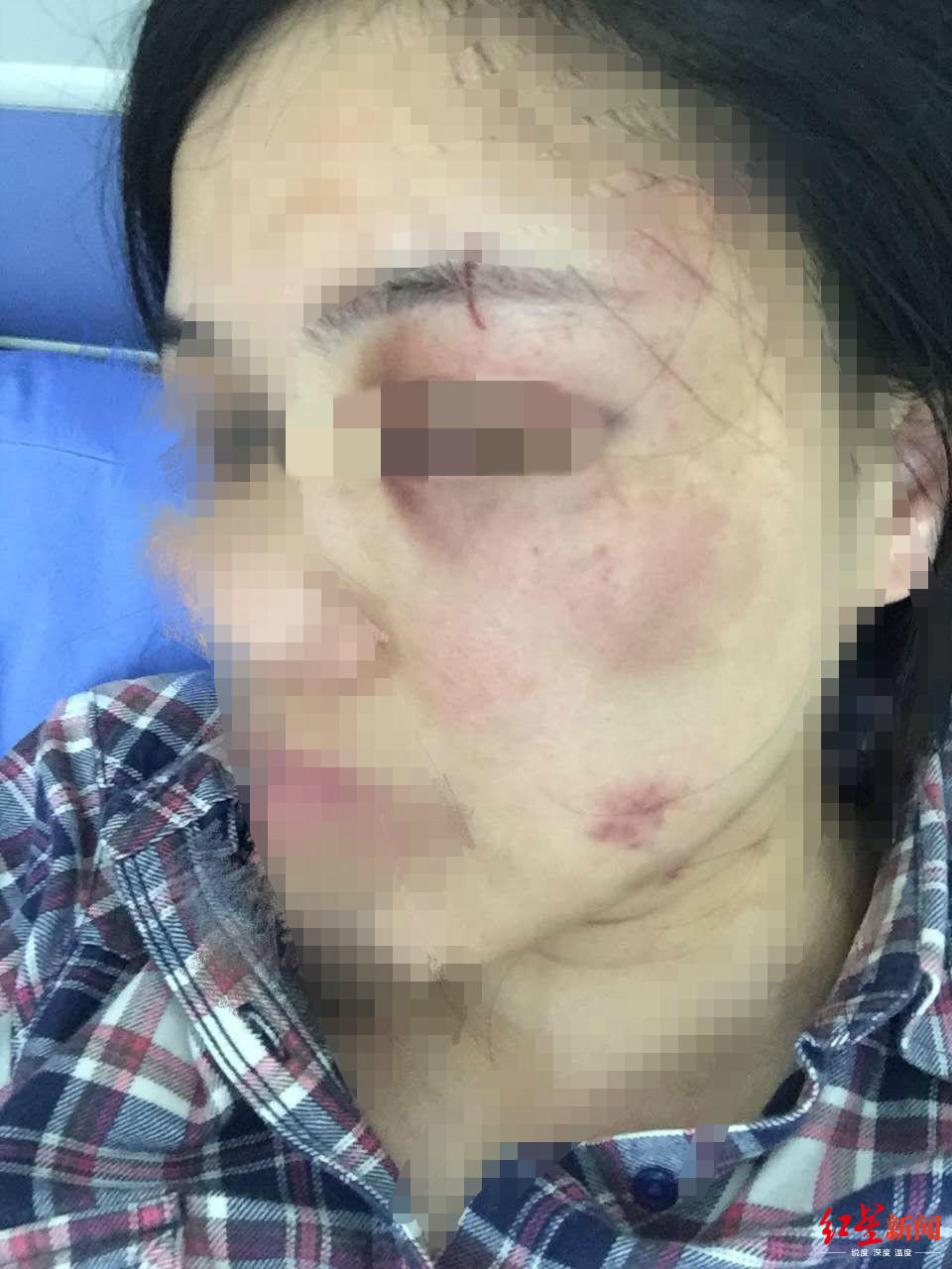 警方介入调解曹县女子家暴事件，维护女性权益正义行动启动